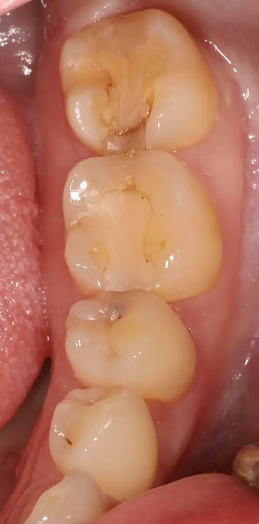 Locust Street Dental Center