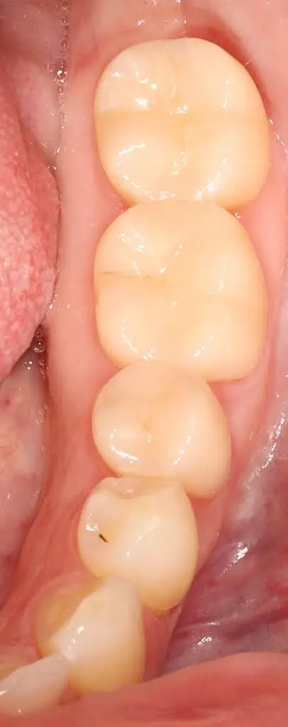 Locust Street Dental Center