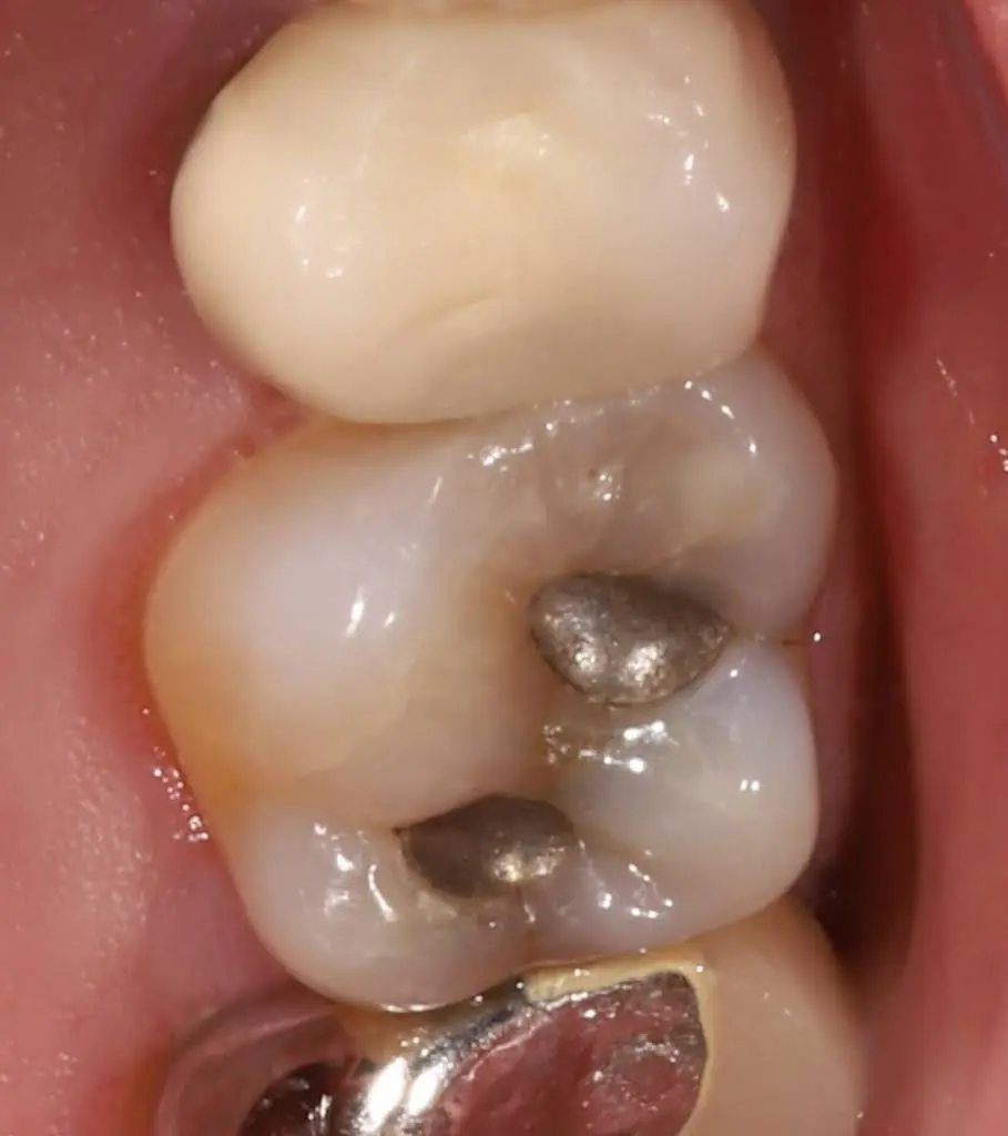 Locust Street Dental Center