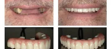 Shaun Janvier, D.M.D., Implant Cosmetic & Family Dentistry