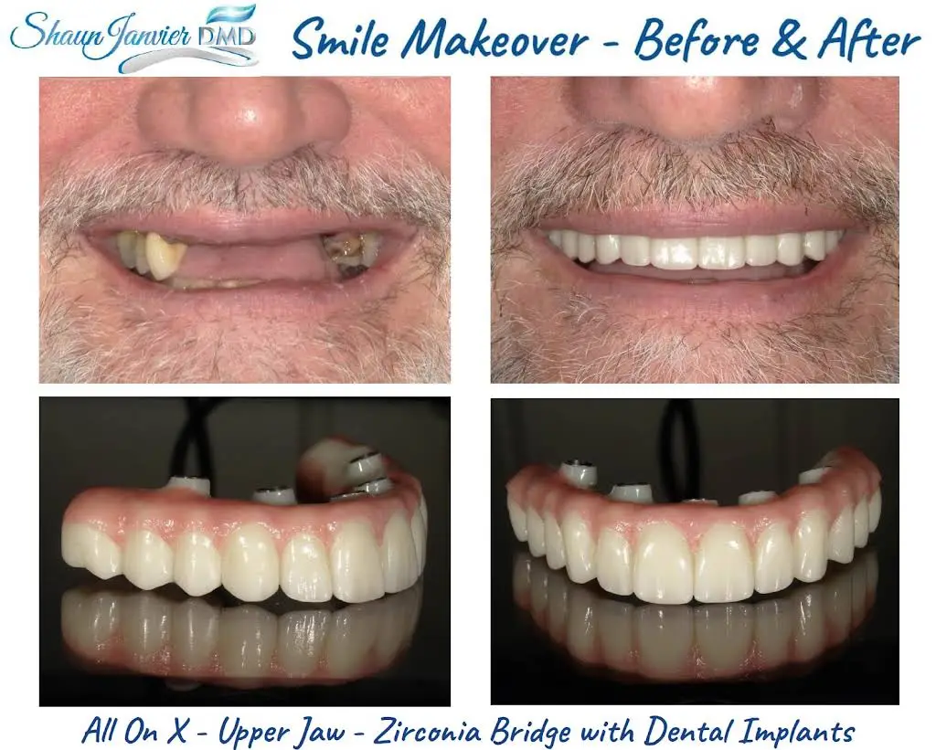 Shaun Janvier, D.M.D., Implant Cosmetic & Family Dentistry - Professional dental clinic exterior with modern facilities