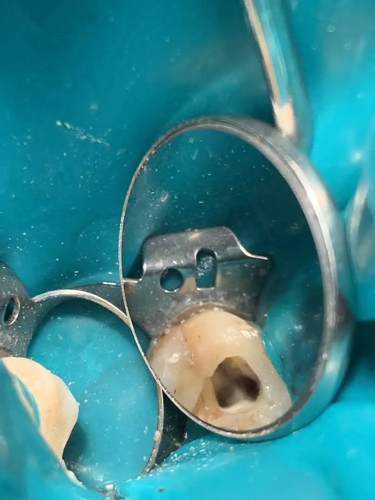 Community Dental