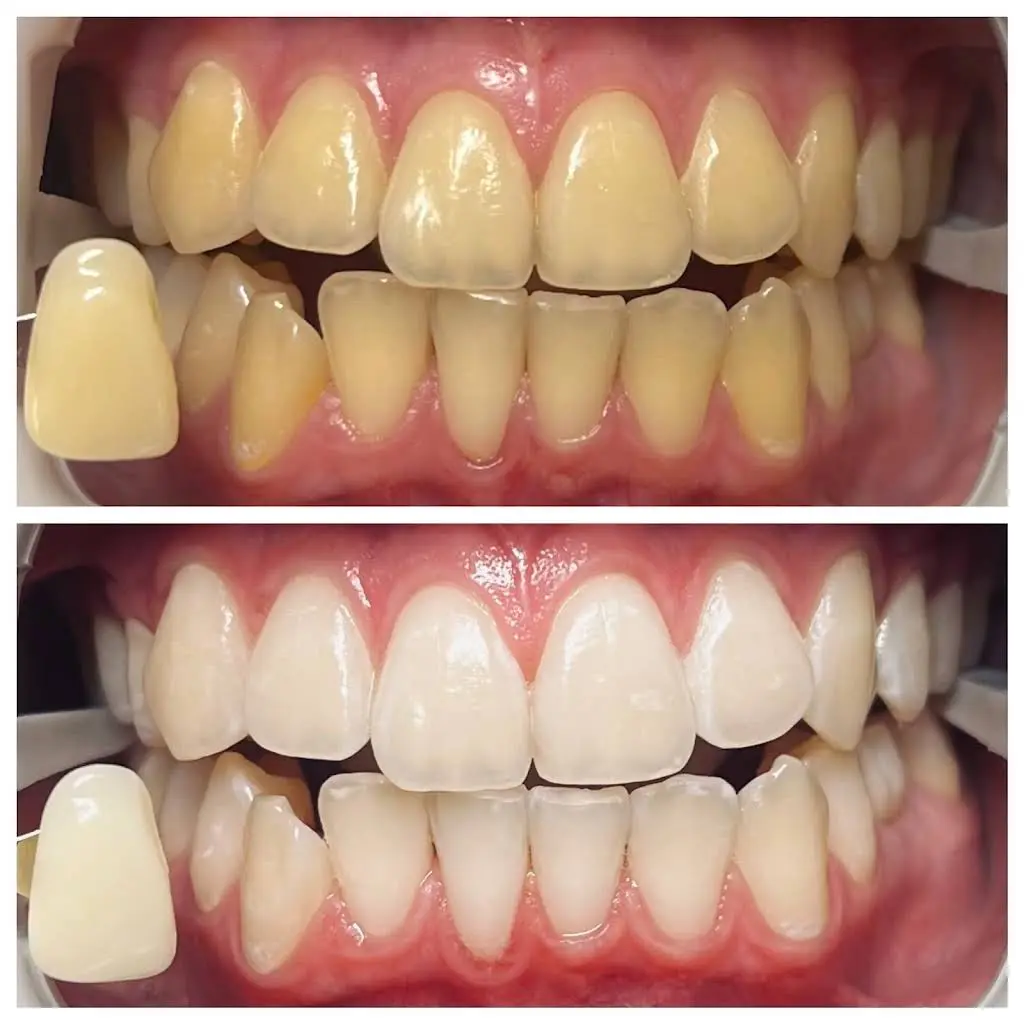 The Whitening Lab