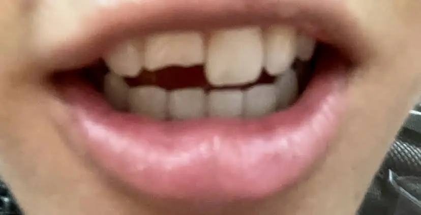 Ultimate Dental Elk Grove