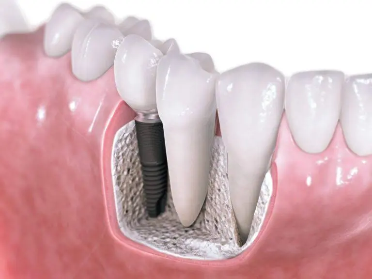 Laguna Pavilion Dental - Professional dental clinic exterior with modern facilities