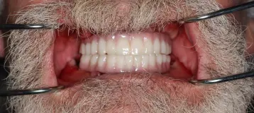 Ora Dental Implant Studio