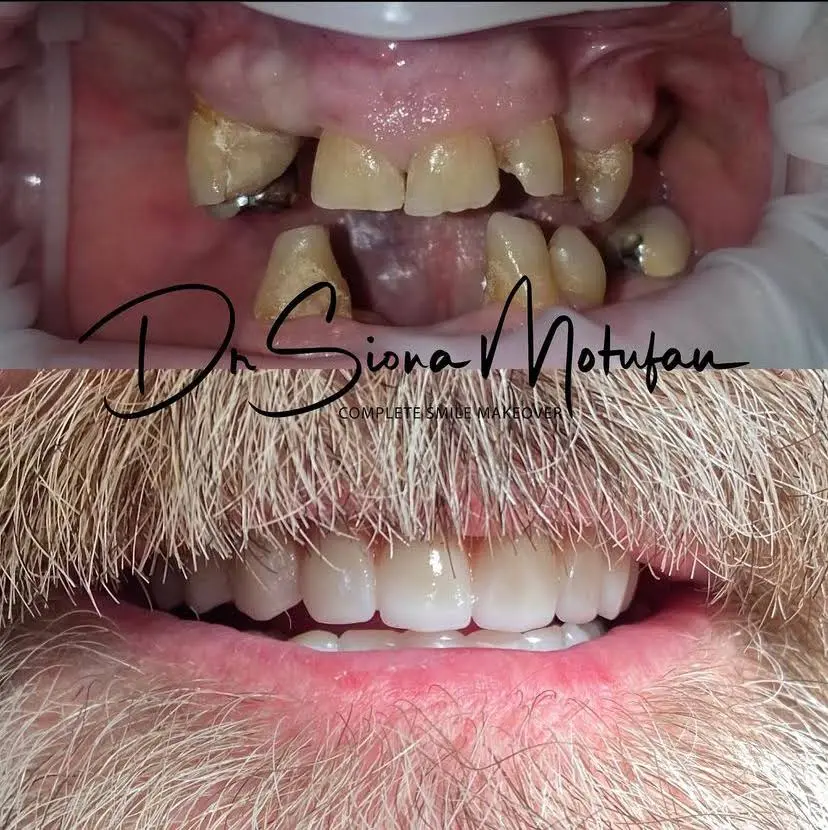 Ohana Dental Implant Centers