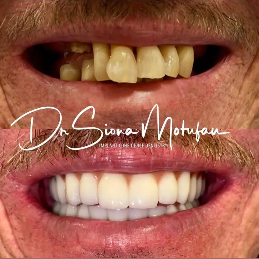 Ohana Dental Implant Centers