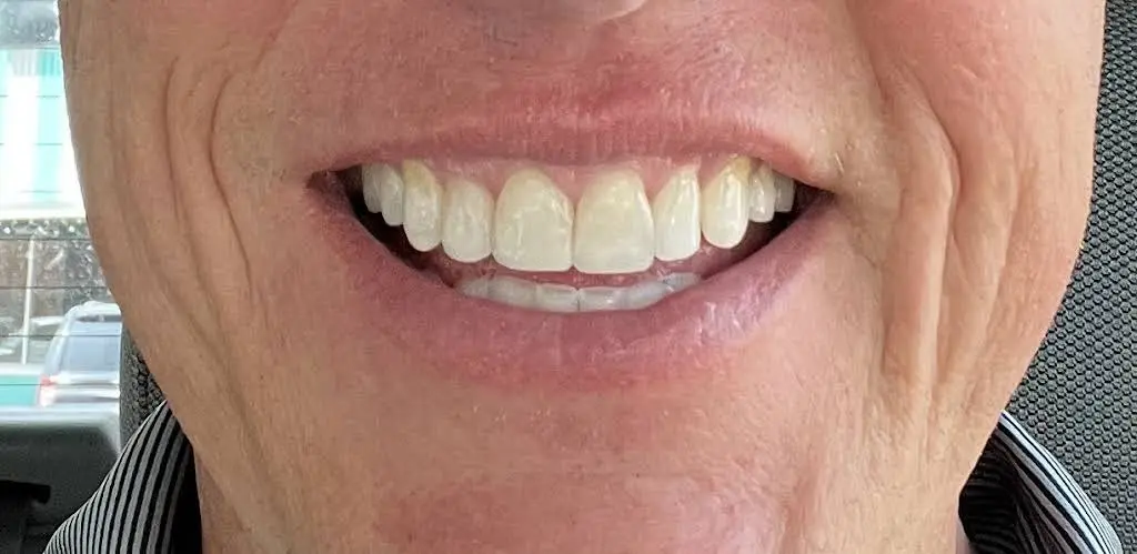 Fort Theatre Dentistry