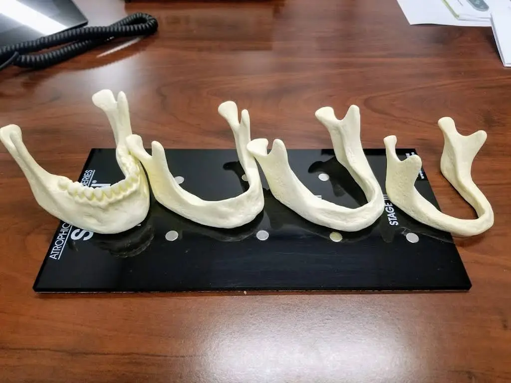 Affordable Dentures & Implants