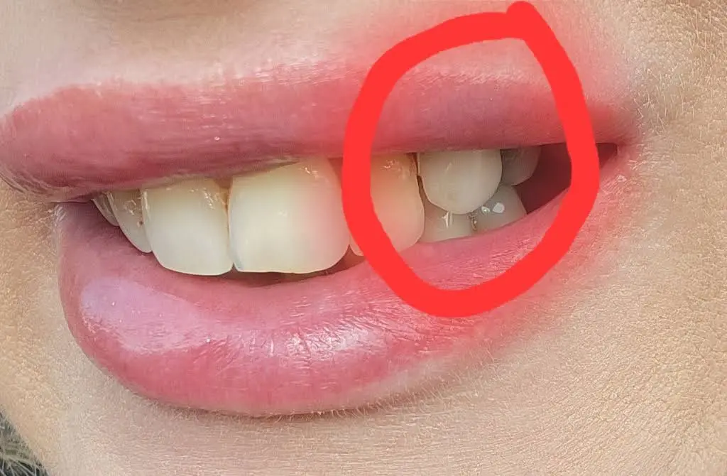 Affordable Dentures & Implants