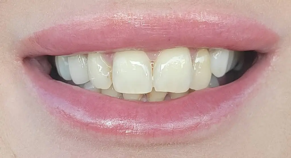 Affordable Dentures & Implants