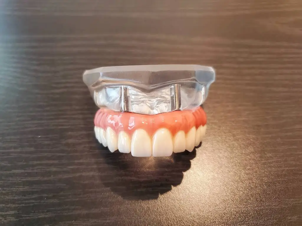 Memphis Dentures and Implants