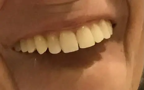 Levee Dental