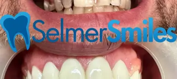 Selmer Smiles
