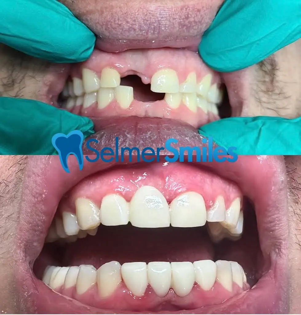 Selmer Smiles