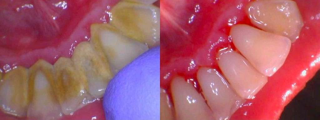 Elite Dental Care