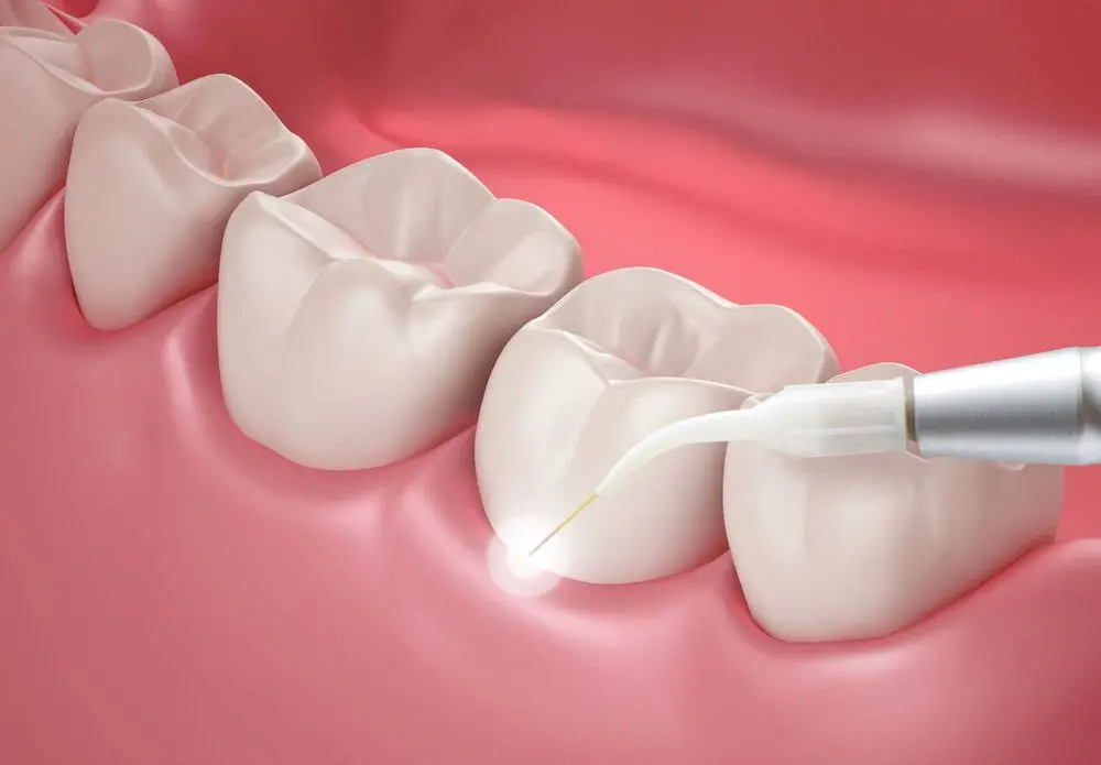 Implant and Family Dentistry: Timothy J. Hacker, DDS