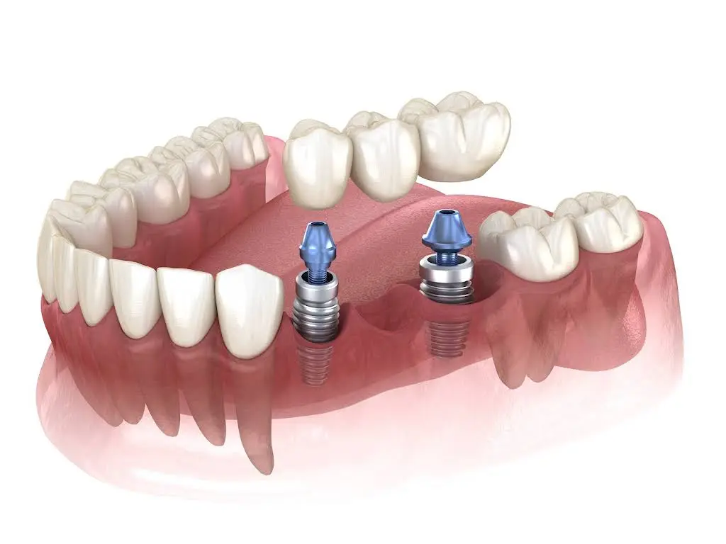 Advanced Dental Implant and TMJ Center