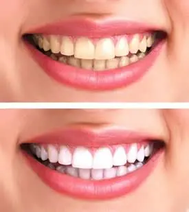 Wilson & Patel Dental Care