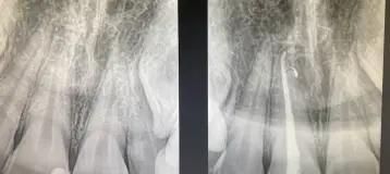 Memphis Endodontics