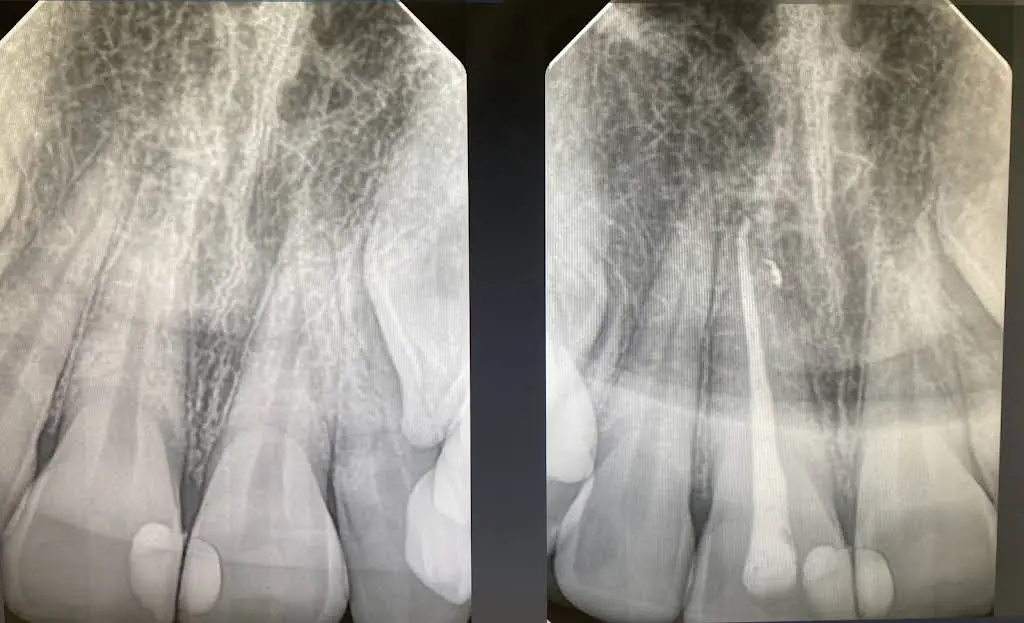 Memphis Endodontics - Professional dental clinic exterior with modern facilities