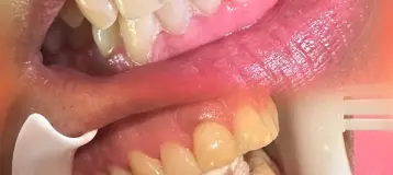 Perfect Smile