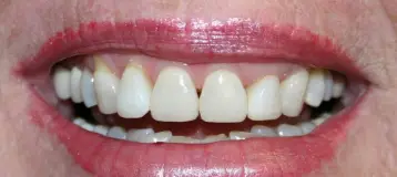 Ginski Family Dentistry of Memphis