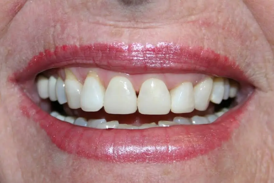 Ginski Family Dentistry of Memphis - Professional dental clinic exterior with modern facilities