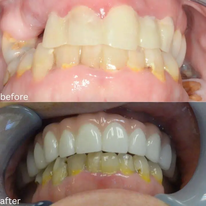 Dental Implant Aesthetic Center