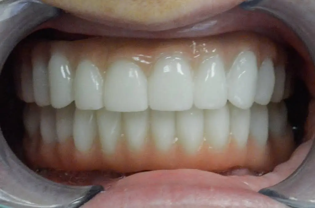 Dental Implant Aesthetic Center