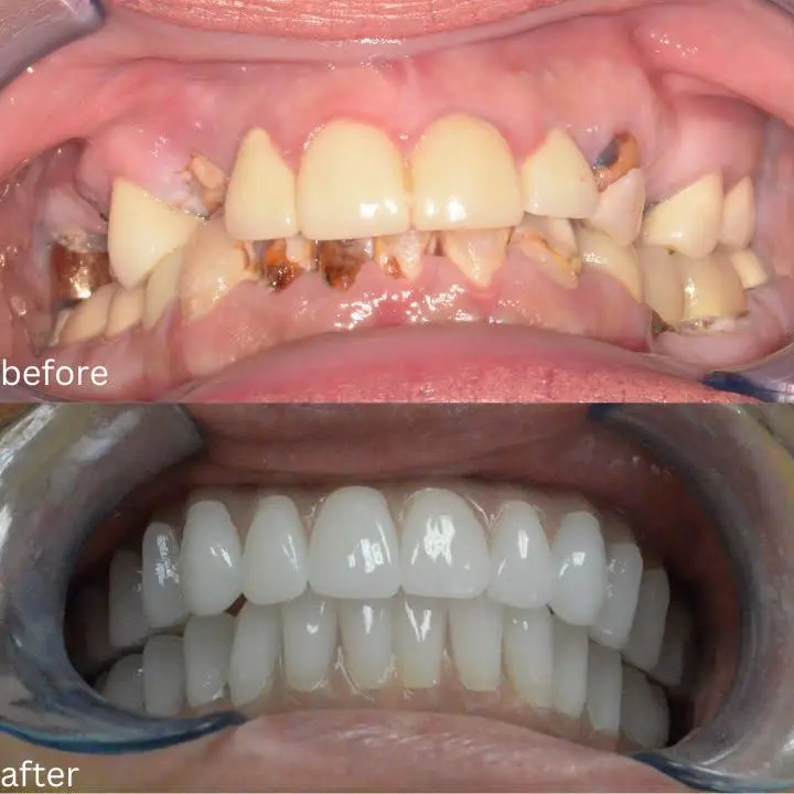 Dental Implant Aesthetic Center