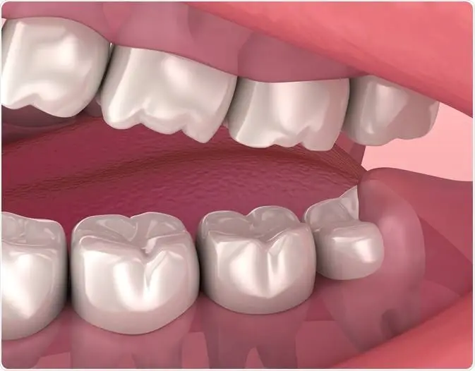 Memphis Oral and Maxillofacial Surgery Group