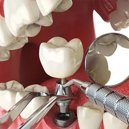 Memphis Oral and Maxillofacial Surgery Group