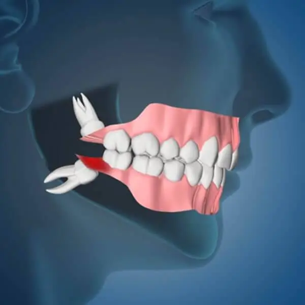 Memphis Oral and Maxillofacial Surgery Group