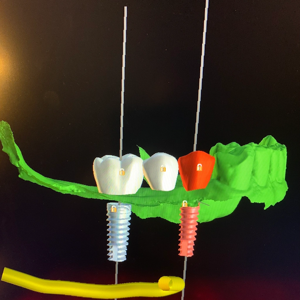 Institute for Periodontics and Implant Dentistry: Lance Culley, DDS