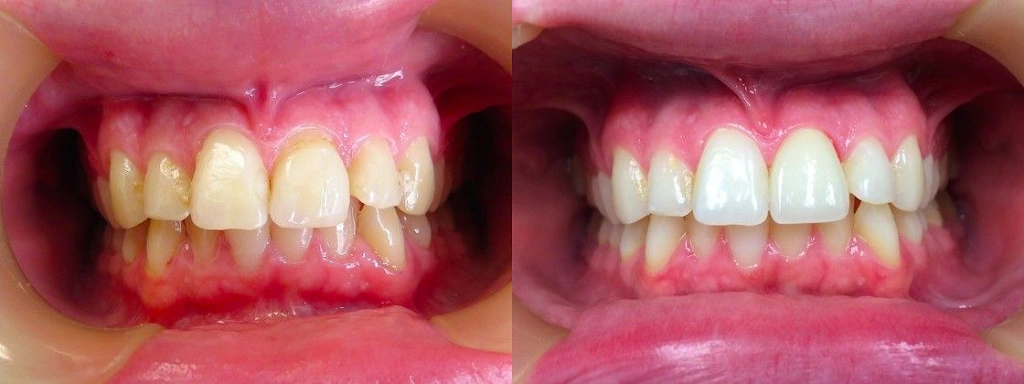 Elite Dental Care