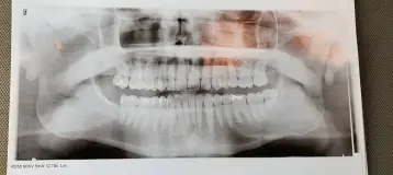 Aspen Dental