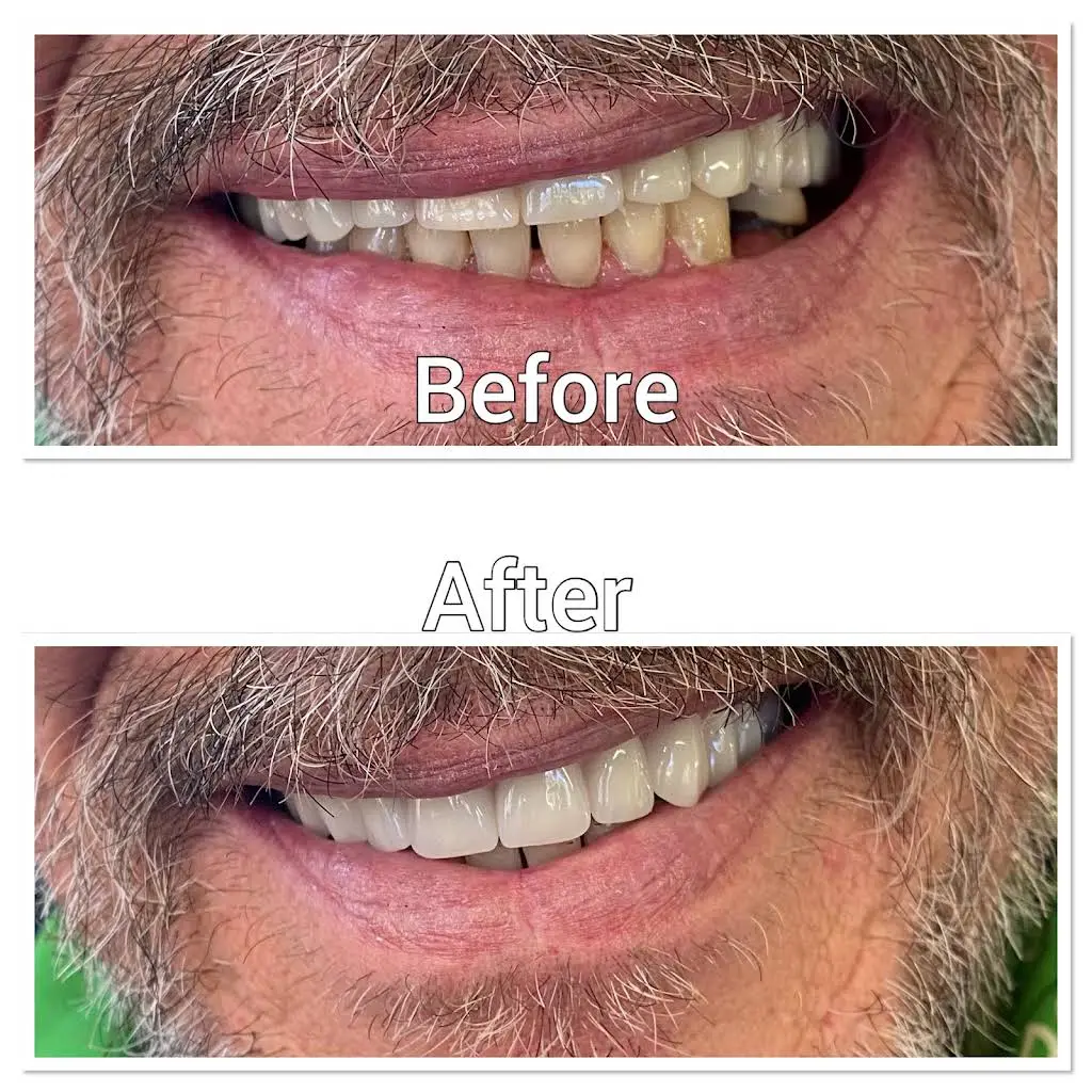 Quality Dentures and Partials LLC
