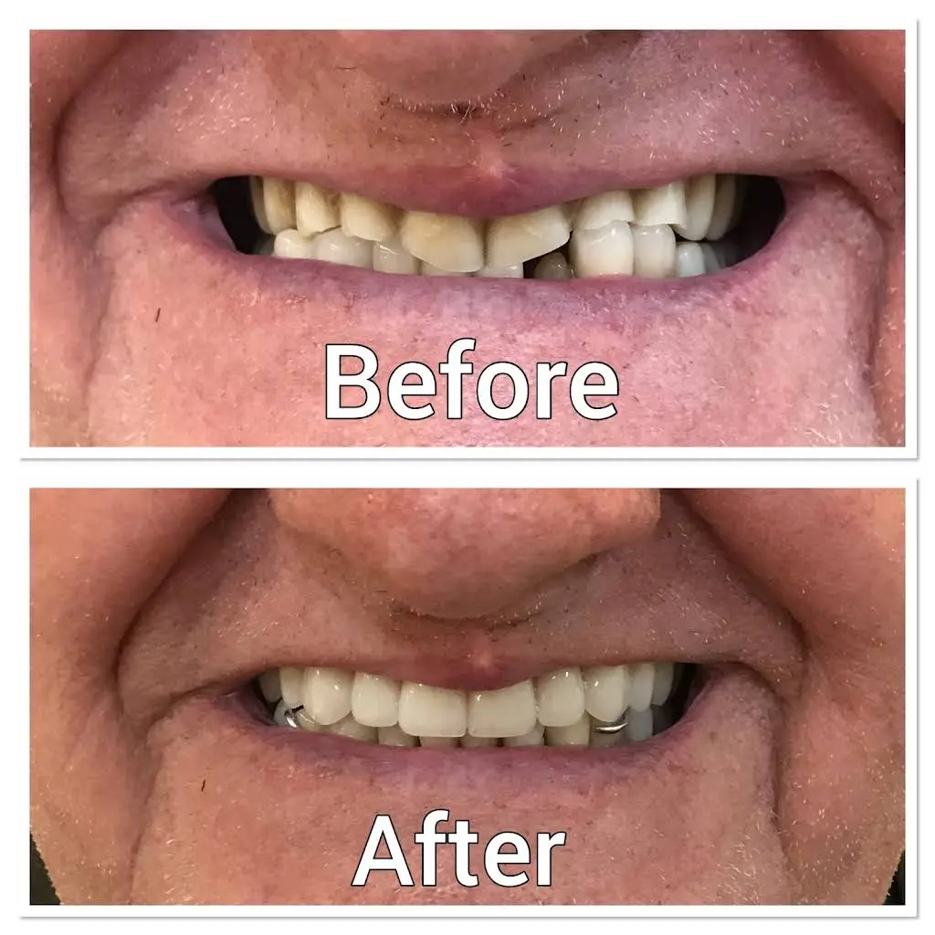 Quality Dentures and Partials LLC