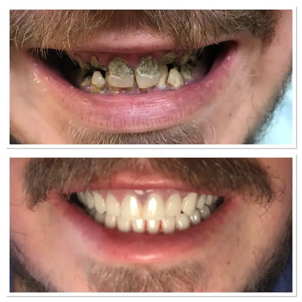 Quality Dentures and Partials LLC