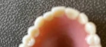 Affordable Dentures & Implants