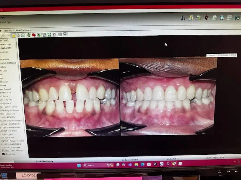 Lisenby Orthodontics