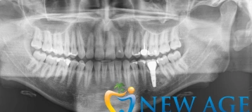 New Age Dentistry of Naples