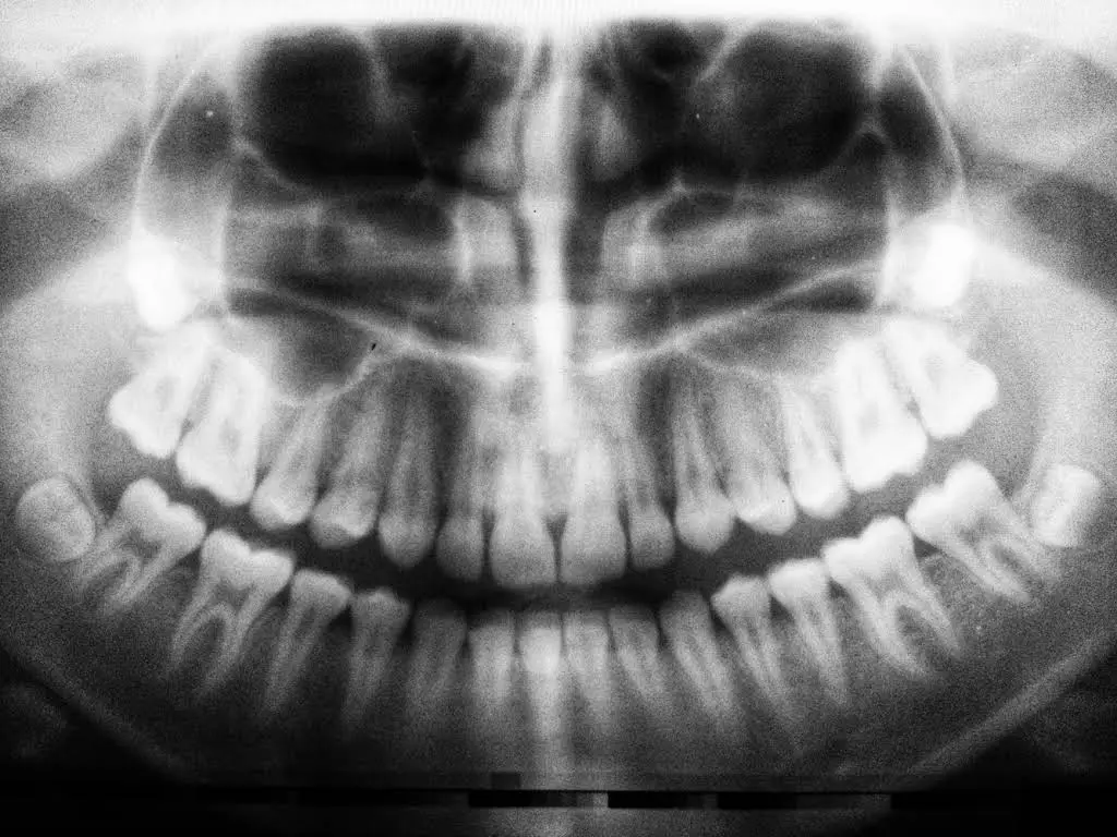 Family Dentistry Naples
