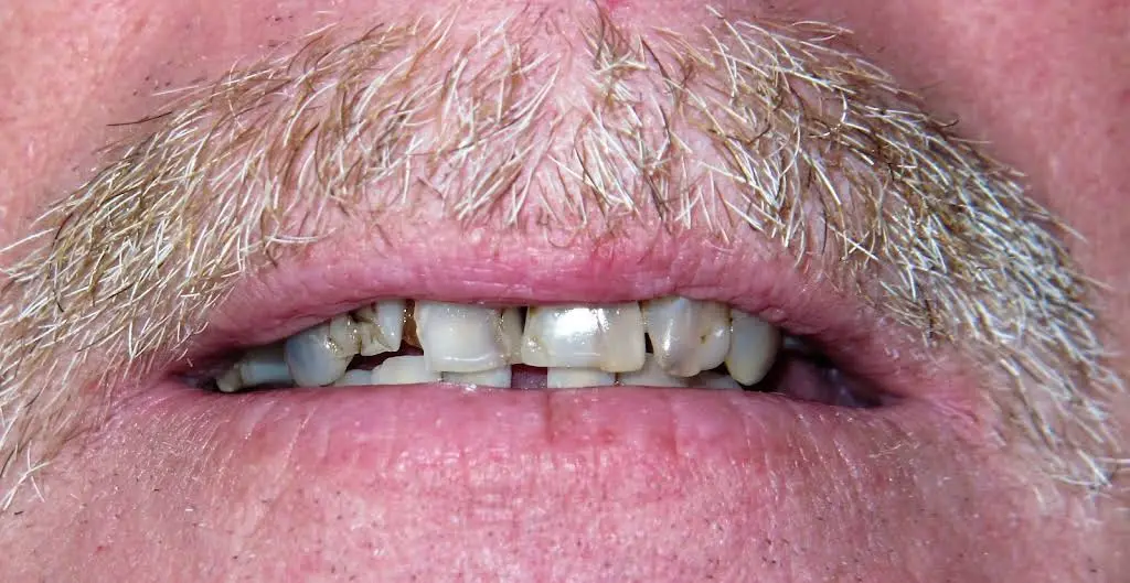 Affordable Dental Care