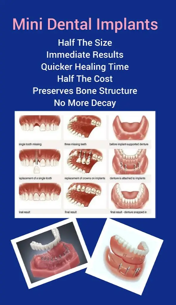 Affordable Dental Care