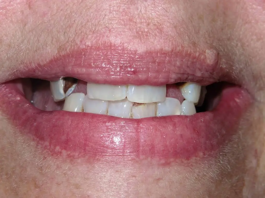 Affordable Dental Care