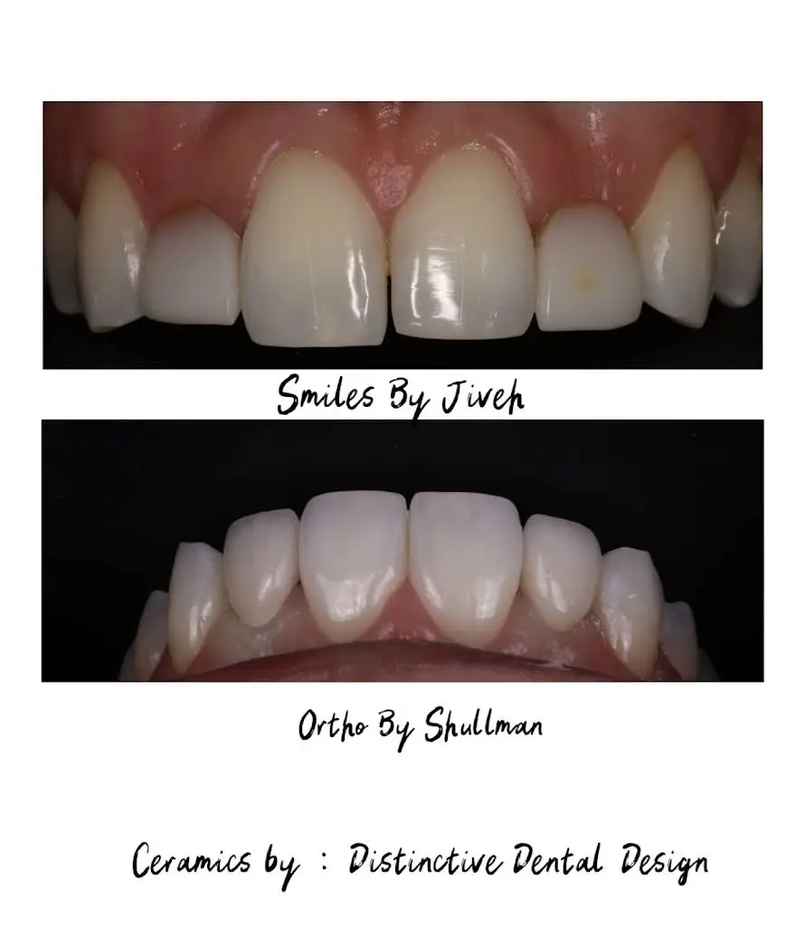 Smiles by Jiveh