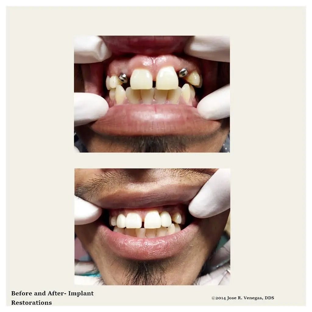 Family Dentistry of Bonita
